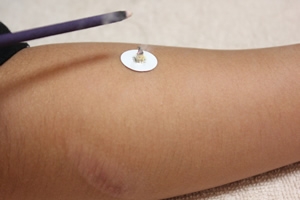 直接のせるお灸 defference0